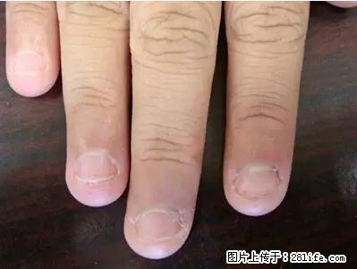 剪指甲、挖耳屎，这些日常小动作竟隐藏大危害！ - 衡阳生活资讯 - 衡阳28生活网 hy.28life.net